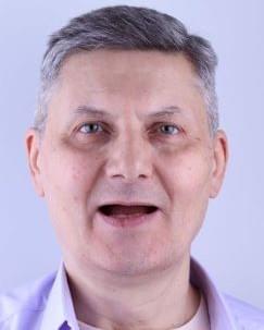 До имплантации