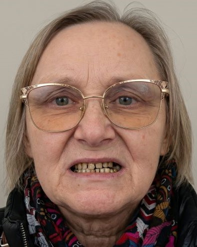 До