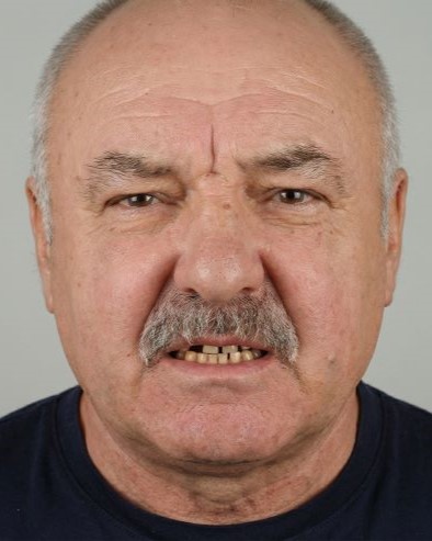 До