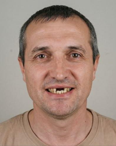 До